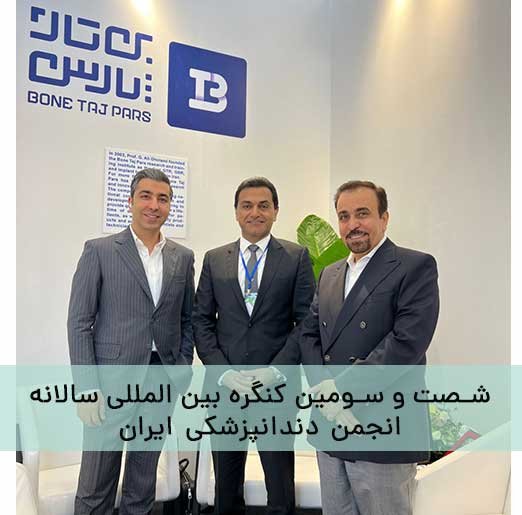 کنگره ها